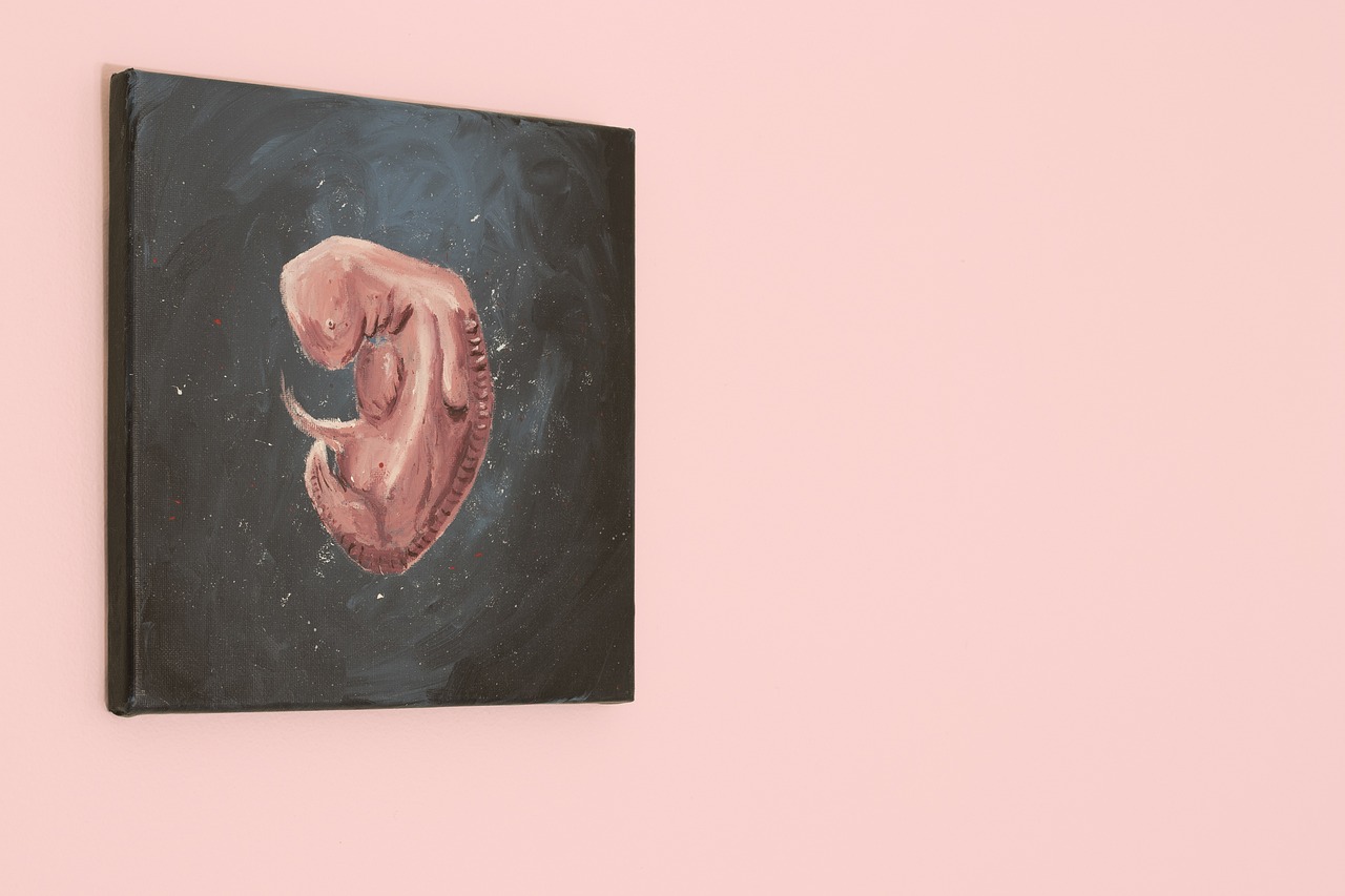Abortusz 5891689